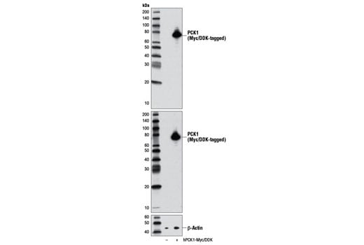 undefined Image 13: Gluconeogenesis Antibody Sampler Kit