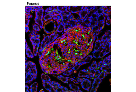 undefined Image 11: Phospho-VEGF Receptor 2 Antibody Sampler Kit