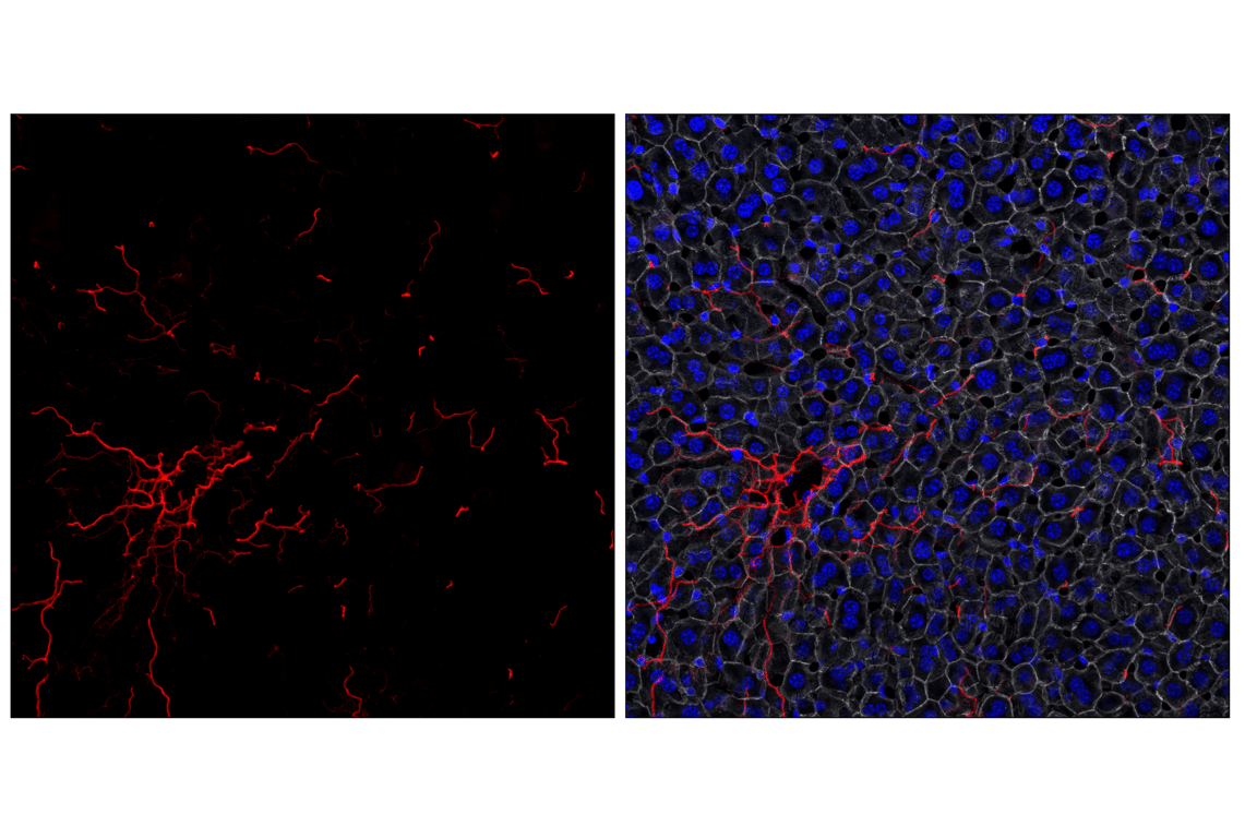 Immunofluorescence Image 2: COL1A1 (E8F4L) Rabbit Monoclonal Antibody (Alexa Fluor<sup>®</sup> 555 Conjugate)
