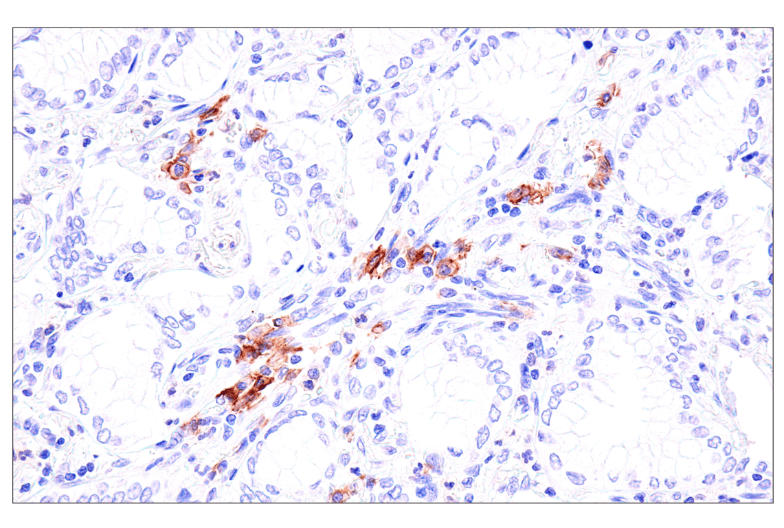 Immunohistochemistry Image 5: Semaphorin-4A (E5N3K) Rabbit Monoclonal Antibody