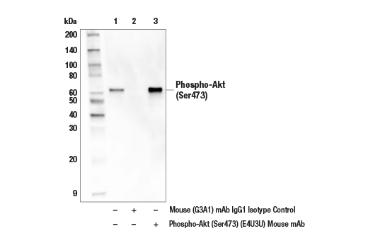 Immunoprecipitation Image 1: Phospho-Akt (Ser473) (E4U3U) Mouse Monoclonal Antibody