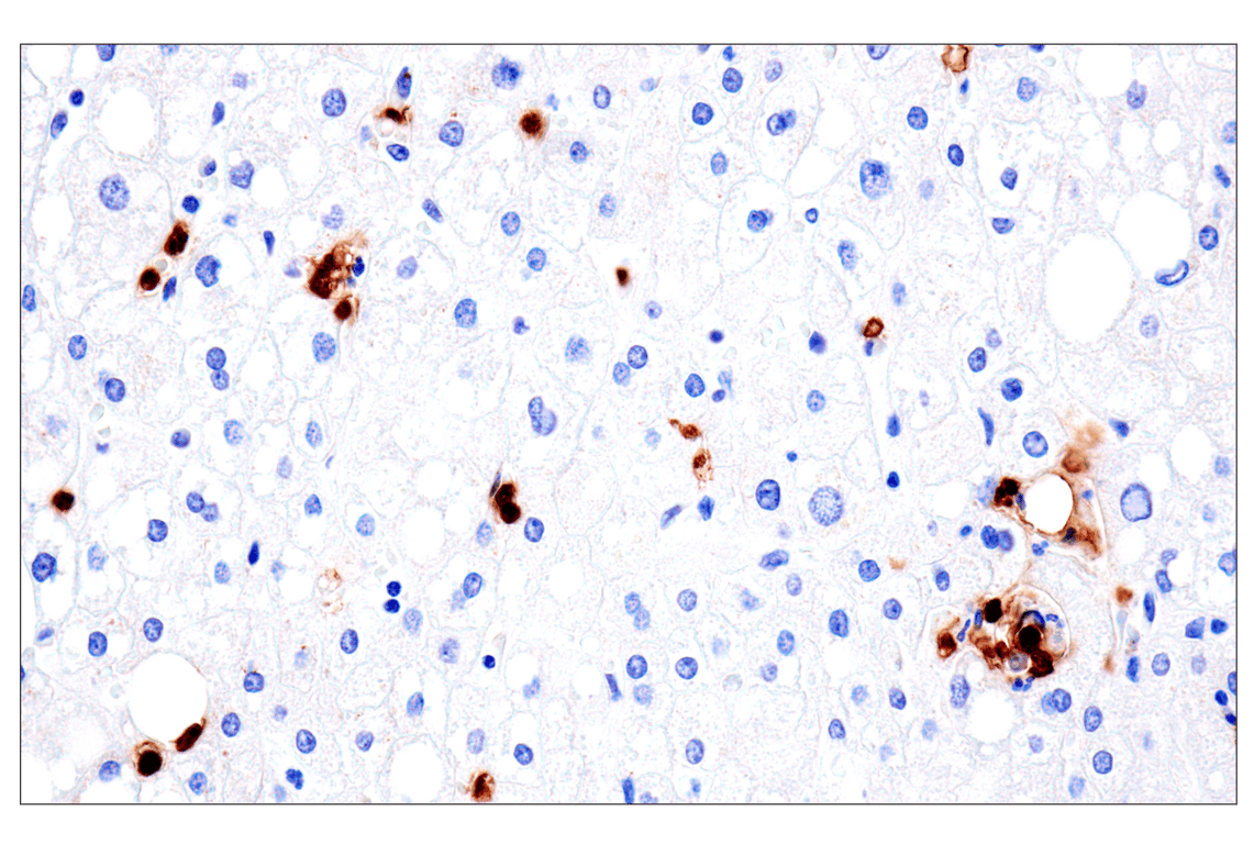 Immunohistochemistry Image 14: CD177 (F9O5U) Rabbit Monoclonal Antibody