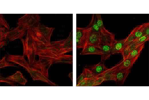 Immunofluorescence Image 1: Phospho-Chk1 (Ser345) (133D3) Rabbit Monoclonal Antibody (BSA and Azide Free)