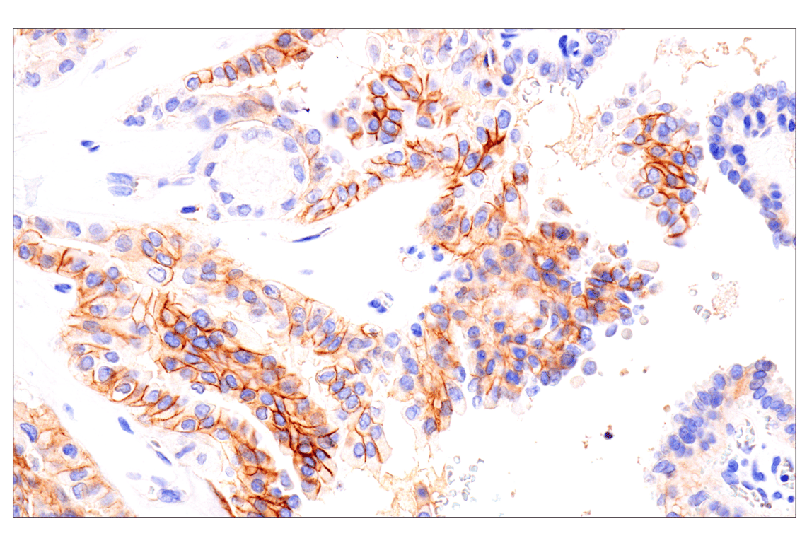 Immunohistochemistry Image 5: EphA2 (D4A2) Rabbit Monoclonal Antibody