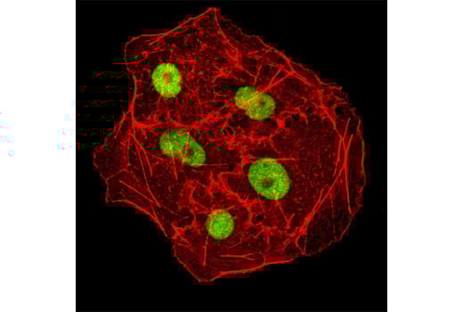 undefined Image 9: DNA Methylation Antibody Sampler Kit