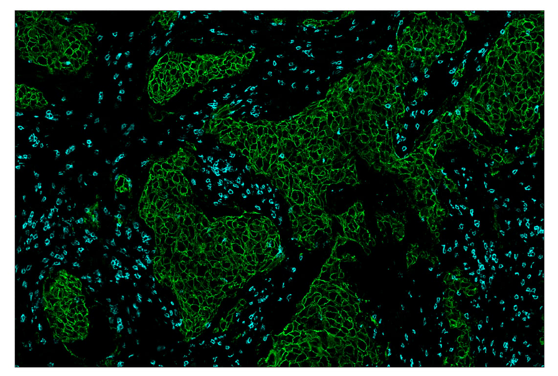 Immunohistochemistry Image 1: HER2/ErbB2 (D8F12) & CO-0019-488 SignalStar<sup>™</sup> Oligo-Antibody Pair