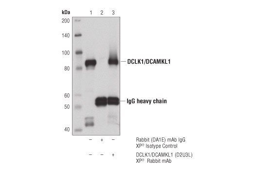 Immunoprecipitation Image 1: DCLK1/DCAMKL1 (D2U3L) Rabbit Monoclonal Antibody