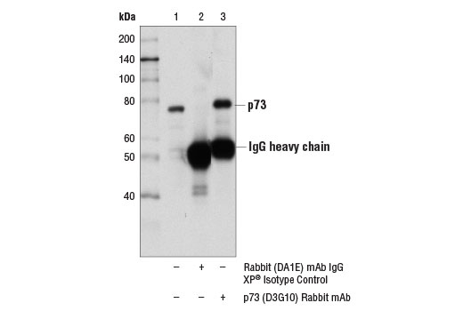 Immunoprecipitation Image 1: p73 (D3G10) Rabbit Monoclonal Antibody