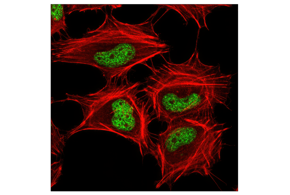 Immunofluorescence Image 1: Tri-Methyl-Histone H3 (Lys27) (C36B11) Rabbit Monoclonal Antibody
