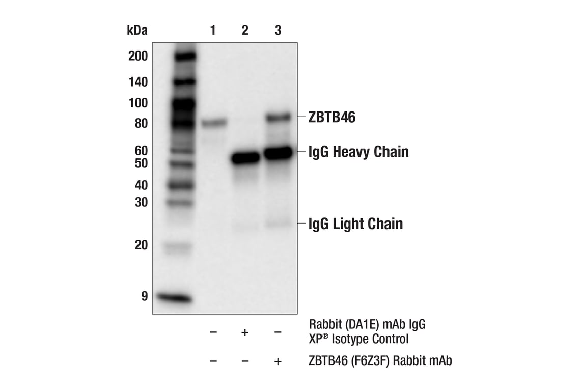 Immunoprecipitation Image 1: ZBTB46 (F6Z3F) Rabbit Monoclonal Antibody