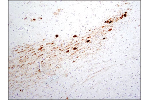 Immunohistochemistry Image 1: Phospho-Tyrosine Hydroxylase (Ser31) (D6I9V) Rabbit Monoclonal Antibody
