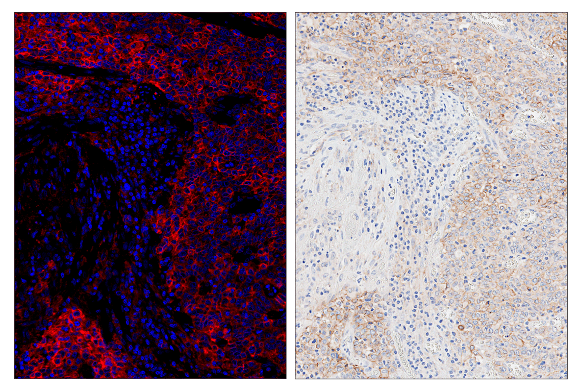 Immunohistochemistry Image 4: SignalStar<sup>™</sup> Miniplex IHC Buffer Kit