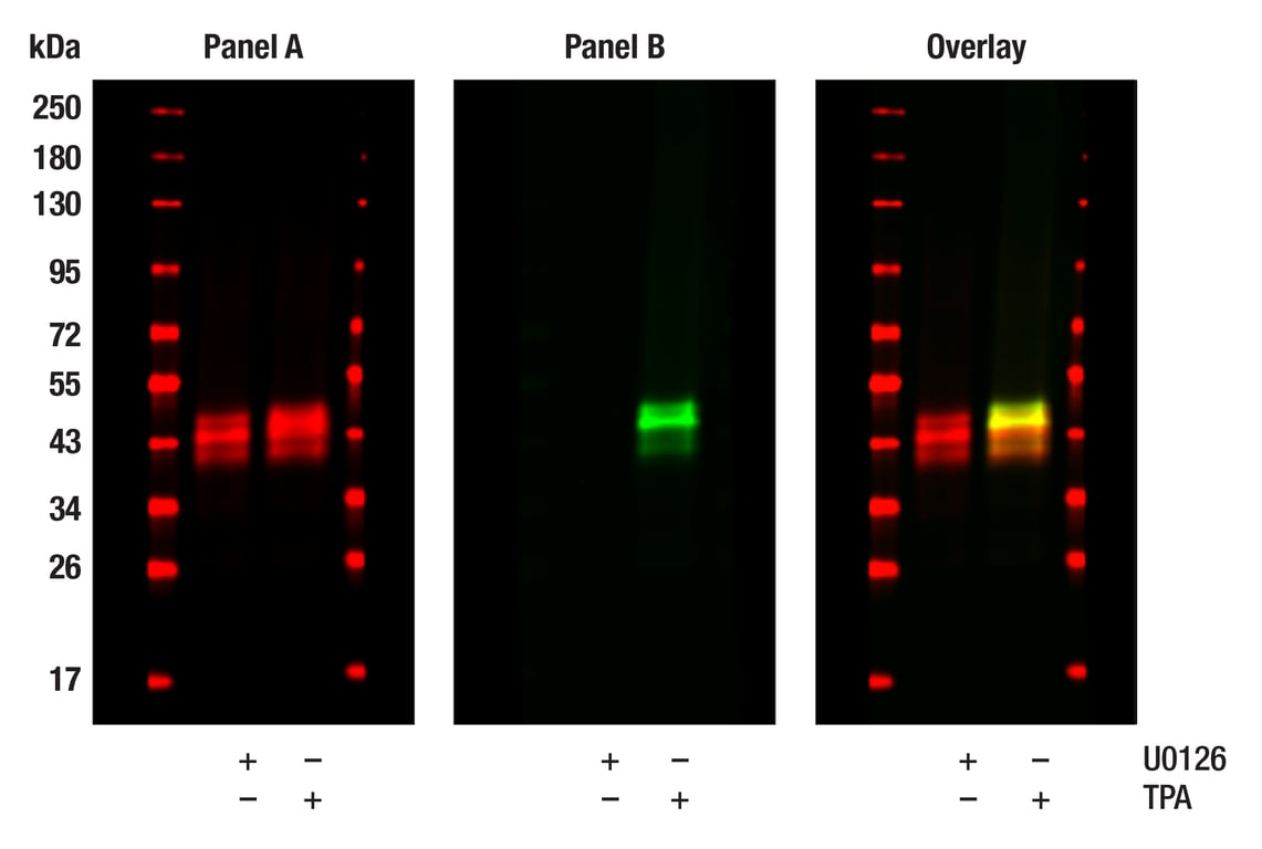 Western Blotting Image 1: Phospho-p44/42 MAPK (Erk1/2) (Thr202/Tyr204) (197G2) Rabbit Monoclonal Antibody