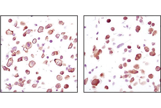 Immunohistochemistry Image 3: Akt (pan) (C67E7) Rabbit Monoclonal Antibody (BSA and Azide Free)