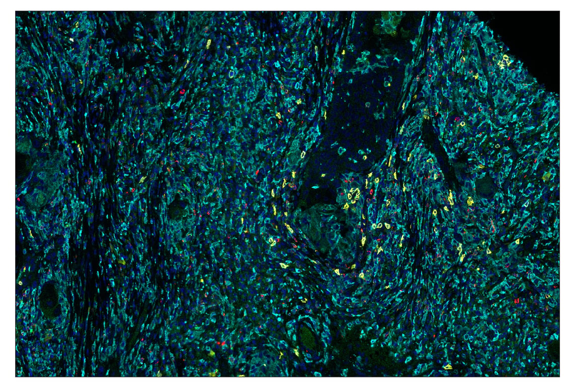Immunohistochemistry Image 1: HLA-DRA (E9R2Q) & CO-0023-647 SignalStar<sup>™</sup> Oligo-Antibody Pair
