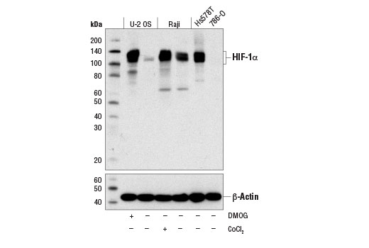 Western Blotting Image 1: HIF-1 alpha (D2U3T) Rabbit Monoclonal Antibody