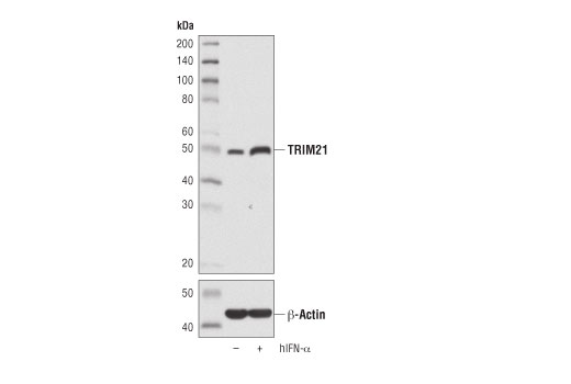 Western Blotting Image 2: TRIM21 (D1O1D) Rabbit Monoclonal Antibody