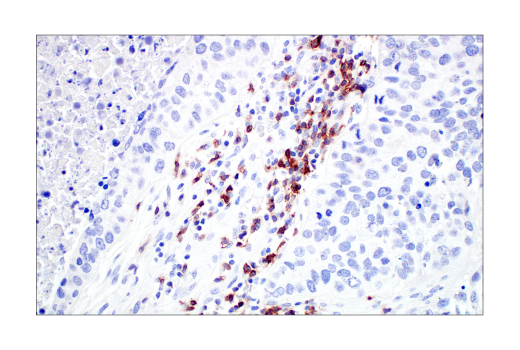 Immunohistochemistry Image 6: TIGIT (E5Y1W) Rabbit Monoclonal Antibody