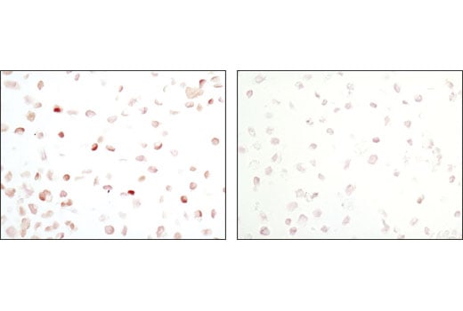 Immunohistochemistry Image 2: Phospho-Stat5 (Tyr694) (C71E5) Rabbit Monoclonal Antibody (BSA and Azide Free)