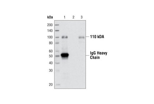 undefined Image 9: Met Signaling Antibody Sampler Kit