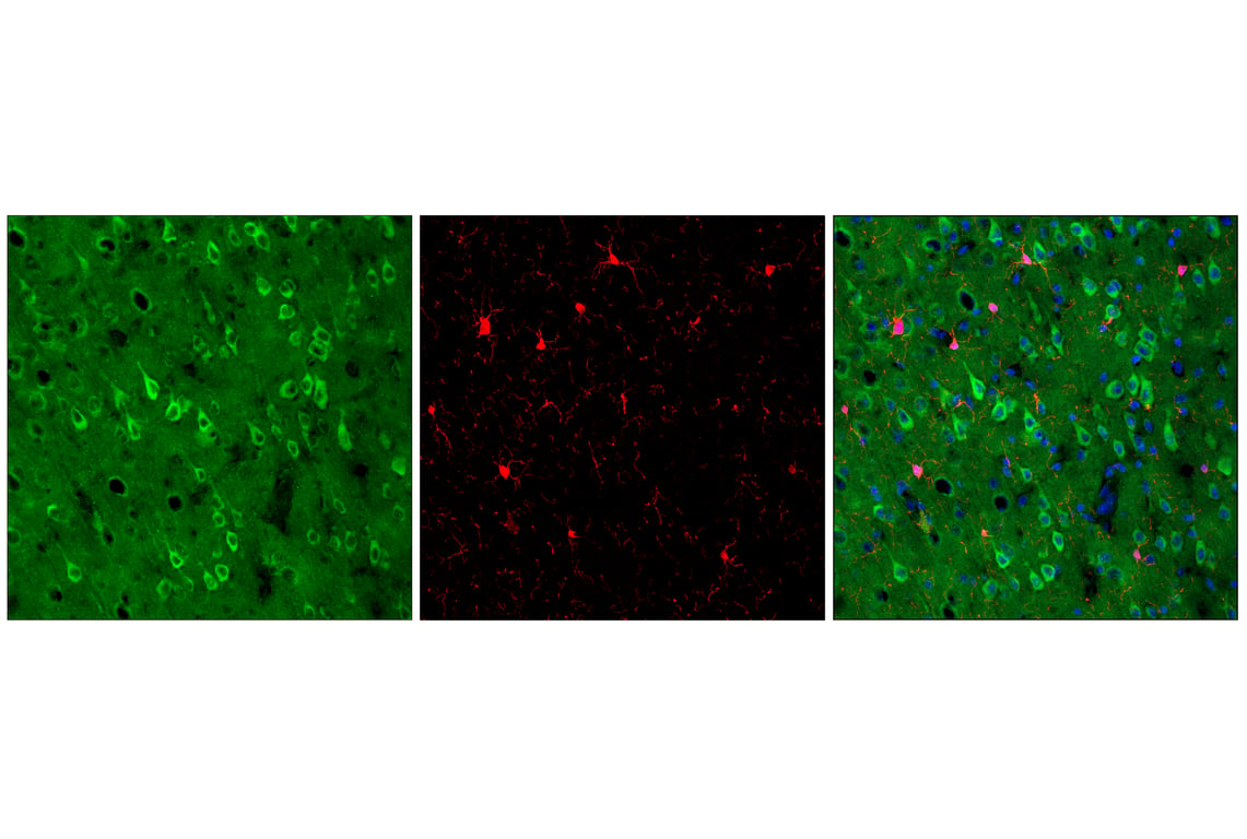 Immunofluorescence Image 1: Rab7 (E9O7E) Mouse mAb (Alexa Fluor<sup>®</sup> 488 Conjugate)