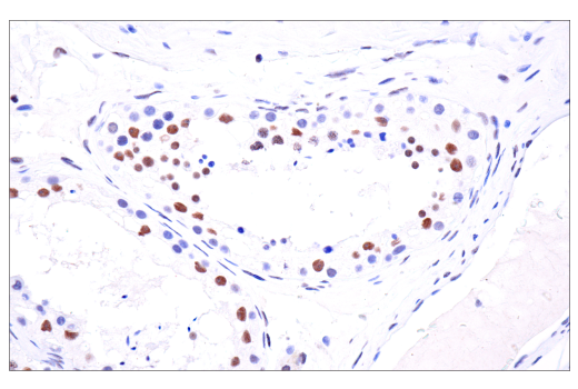 Immunohistochemistry Image 7: PBRM1/BAF180 (D4L9X) Rabbit Monoclonal Antibody (BSA and Azide Free)