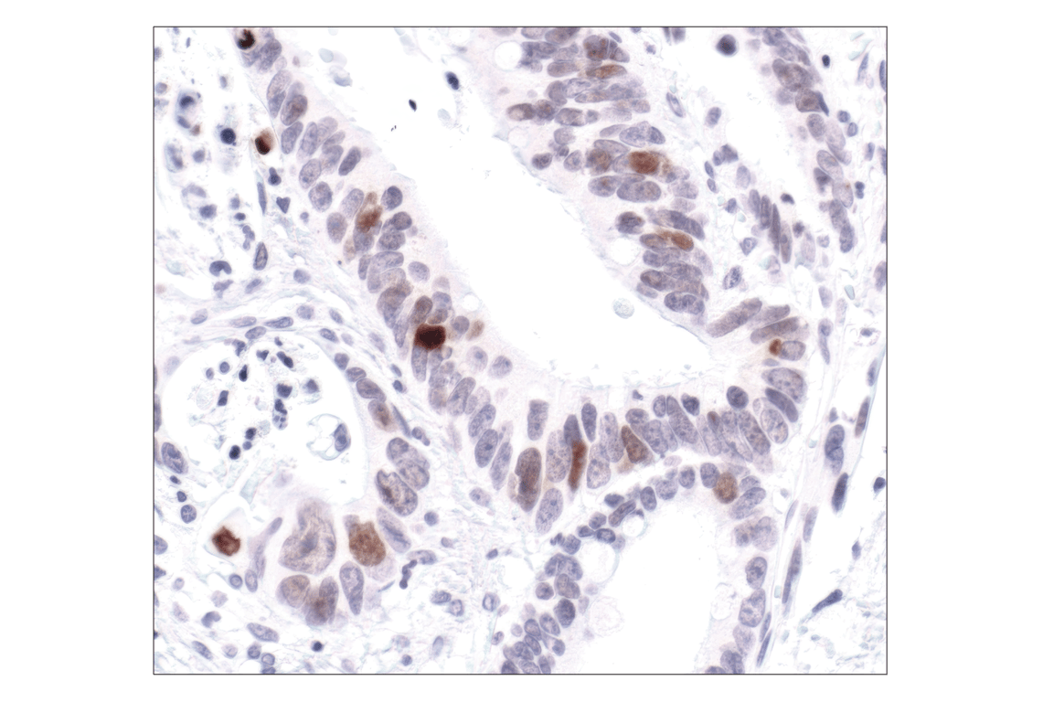 Immunohistochemistry Image 2: Phospho-Histone H2A.X (Ser139) (20E3) Rabbit Monoclonal Antibody