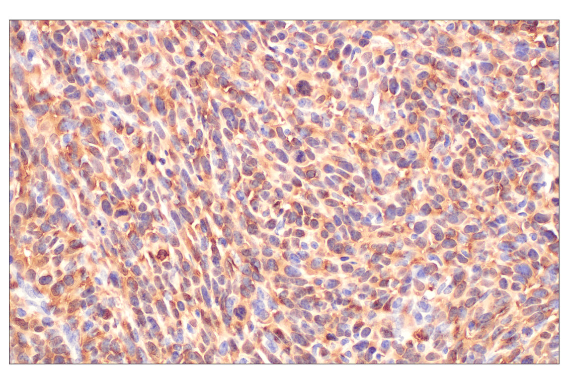 Immunohistochemistry Image 7: MTAP (E5R1I) Rabbit Monoclonal Antibody