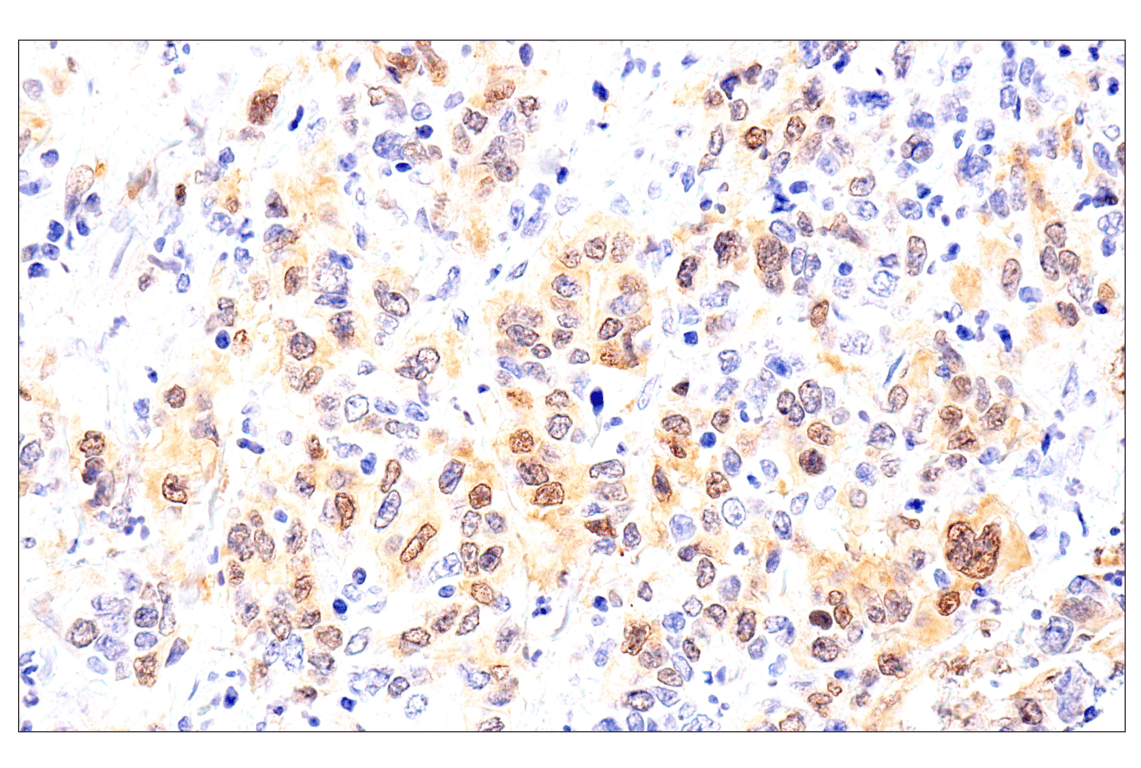 undefined Image 29: Phospho-Chk1/2 Antibody Sampler Kit