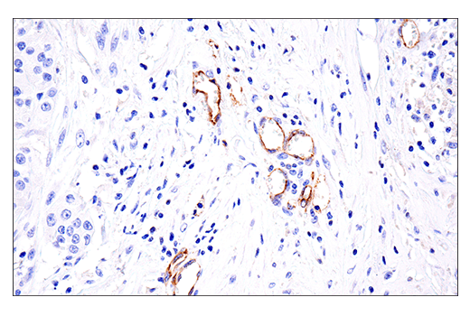 Immunohistochemistry Image 5: VE-Cadherin (E6N7A) Rabbit Monoclonal Antibody (BSA and Azide Free)