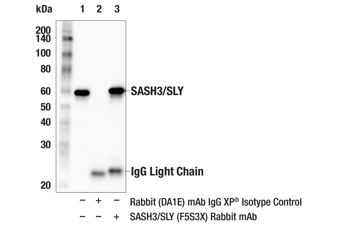 Immunoprecipitation Image 1: SASH3/SLY (F5S3X) Rabbit Monoclonal Antibody