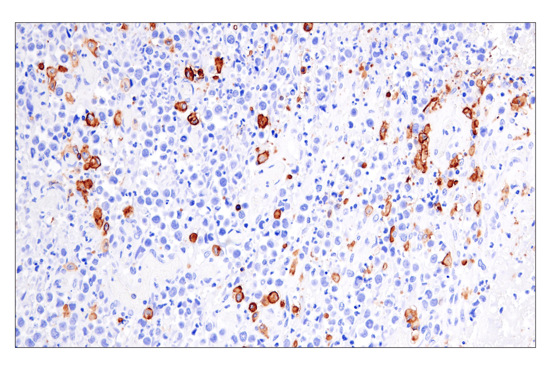 Immunohistochemistry Image 4: HLA-DRA (E9R2Q) Rabbit Monoclonal Antibody (BSA and Azide Free)
