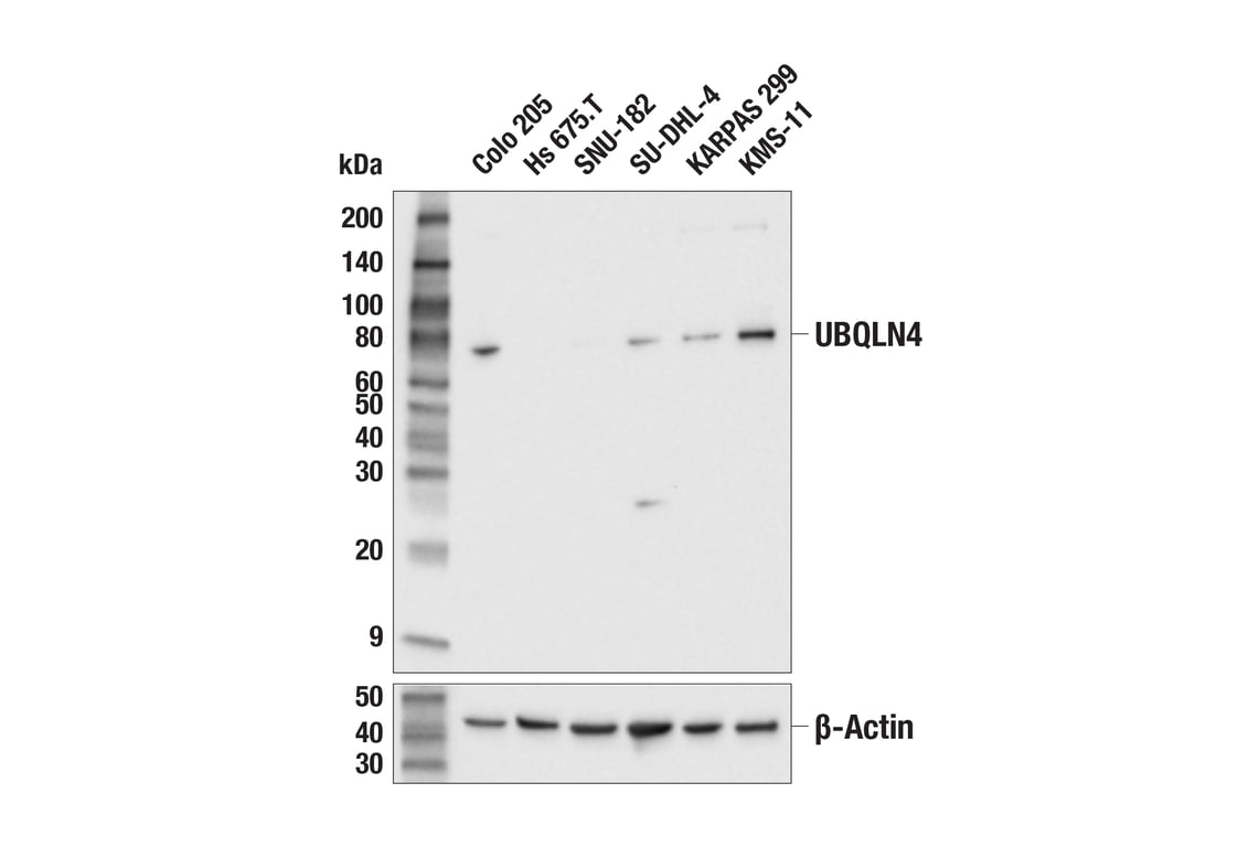 Western Blotting Image 2: UBQLN4 (E7N4Q) Rabbit Monoclonal Antibody