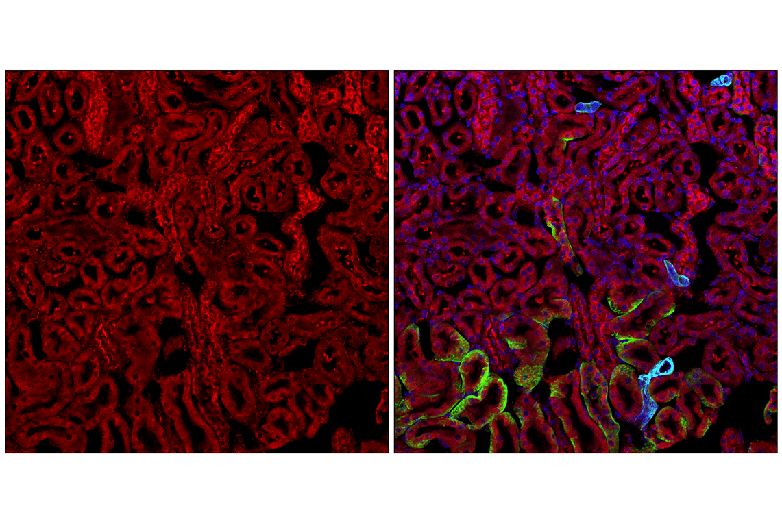 Immunofluorescence Image 2: S6 Ribosomal Protein (54D2) Mouse Monoclonal Antibody (Alexa Fluor<sup>®</sup> 700 Conjugate)