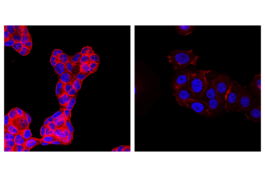 Immunofluorescence Image 1: Ras (E4K9L) Rabbit Monoclonal Antibody (Alexa Fluor<sup>®</sup> 555 Conjugate)