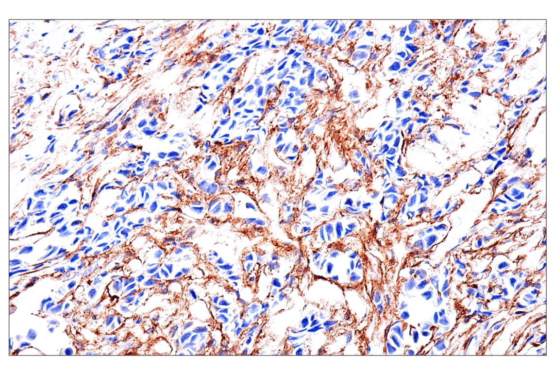 Immunohistochemistry Image 8: FAP (F1A4G) Rabbit Monoclonal Antibody (BSA and Azide Free)