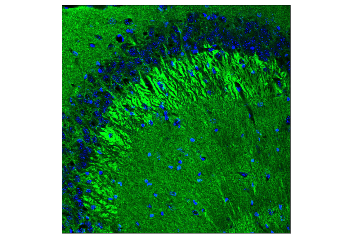 Immunofluorescence Image 1: SNAP25 (F5Z2D) Rabbit Monoclonal Antibody