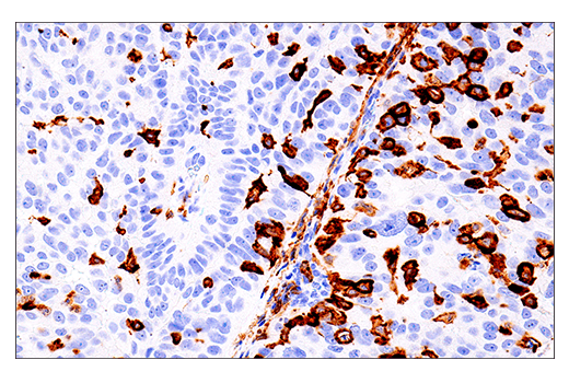 Immunohistochemistry Image 1: LAIR-1 (E7X6I) Rabbit Monoclonal Antibody