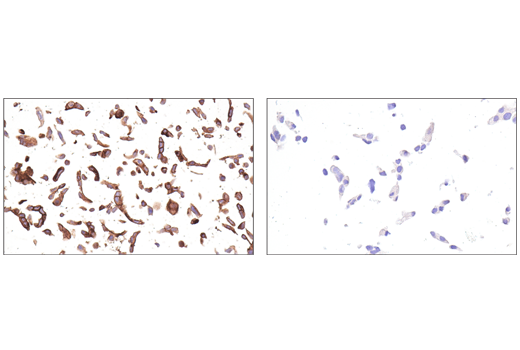 Immunohistochemistry Image 5: DAF/CD55 (E7G2U) Rabbit Monoclonal Antibody
