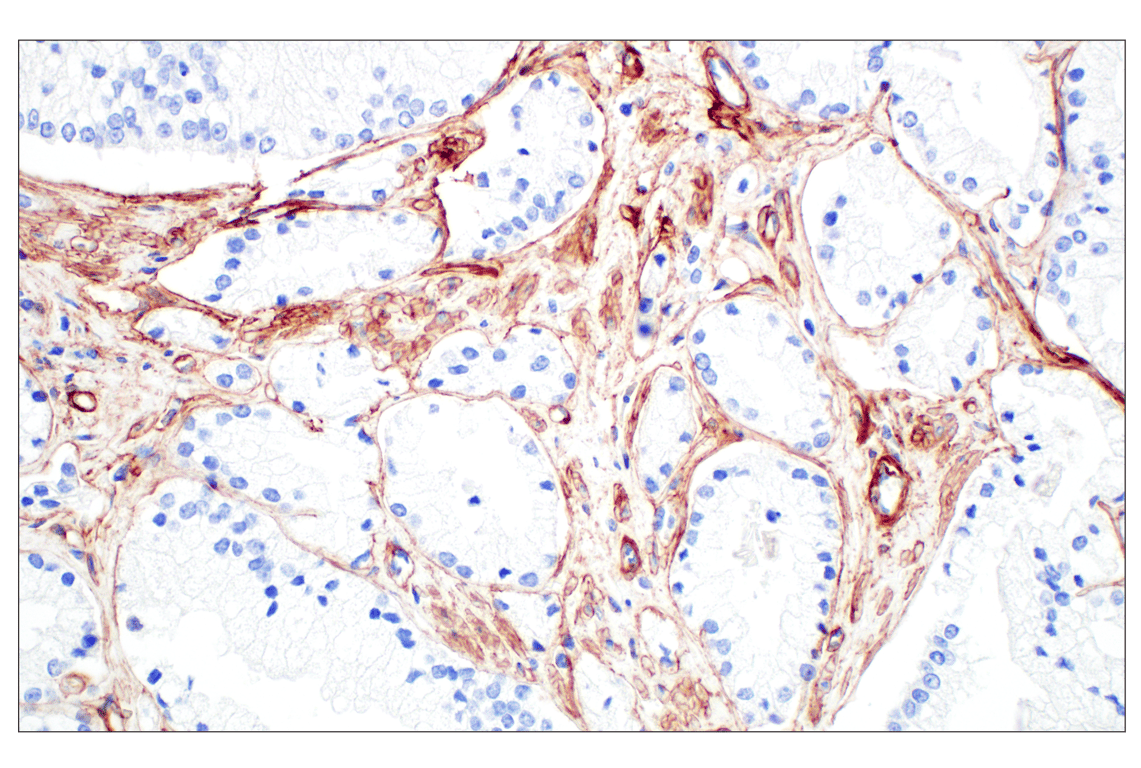 Immunohistochemistry Image 2: COL4A1 (E5M6R) Rabbit Monoclonal Antibody (IHC Formulated)