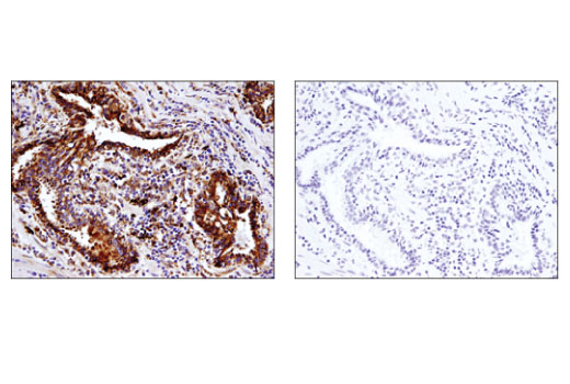 Immunohistochemistry Image 3: Grp94 (D6X2Q) Rabbit Monoclonal Antibody