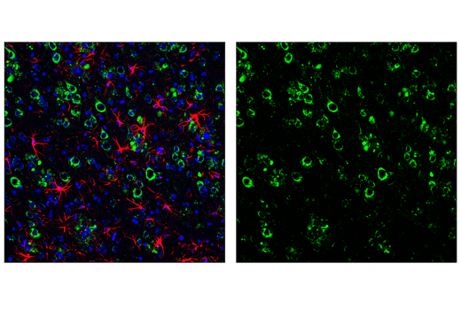 Immunofluorescence Image 2: APP (E5X2B) Rabbit Monoclonal Antibody