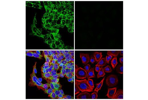 Immunofluorescence Image 1: ANT1/SLC25A4 (E3E9Y) Rabbit Monoclonal Antibody