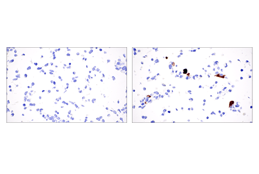 Immunohistochemistry Image 3: S100A8 (E4F8V) Rabbit Monoclonal Antibody