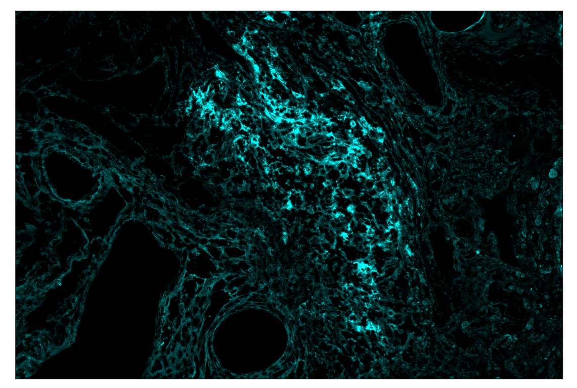 Immunohistochemistry Image 4: CD40 (D8W3N) & CO-0115-750 SignalStar<sup>™</sup> Oligo-Antibody Pair