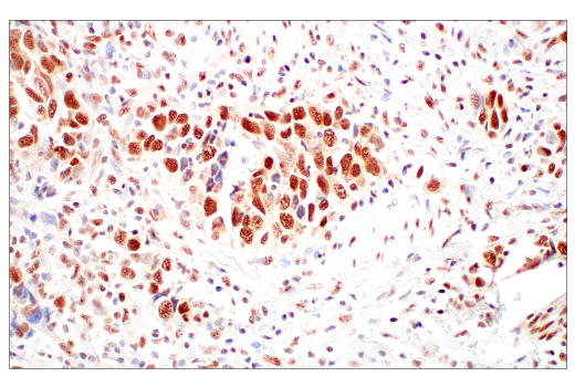 Immunohistochemistry Image 1: Rad50 (E4J5R) Rabbit Monoclonal Antibody