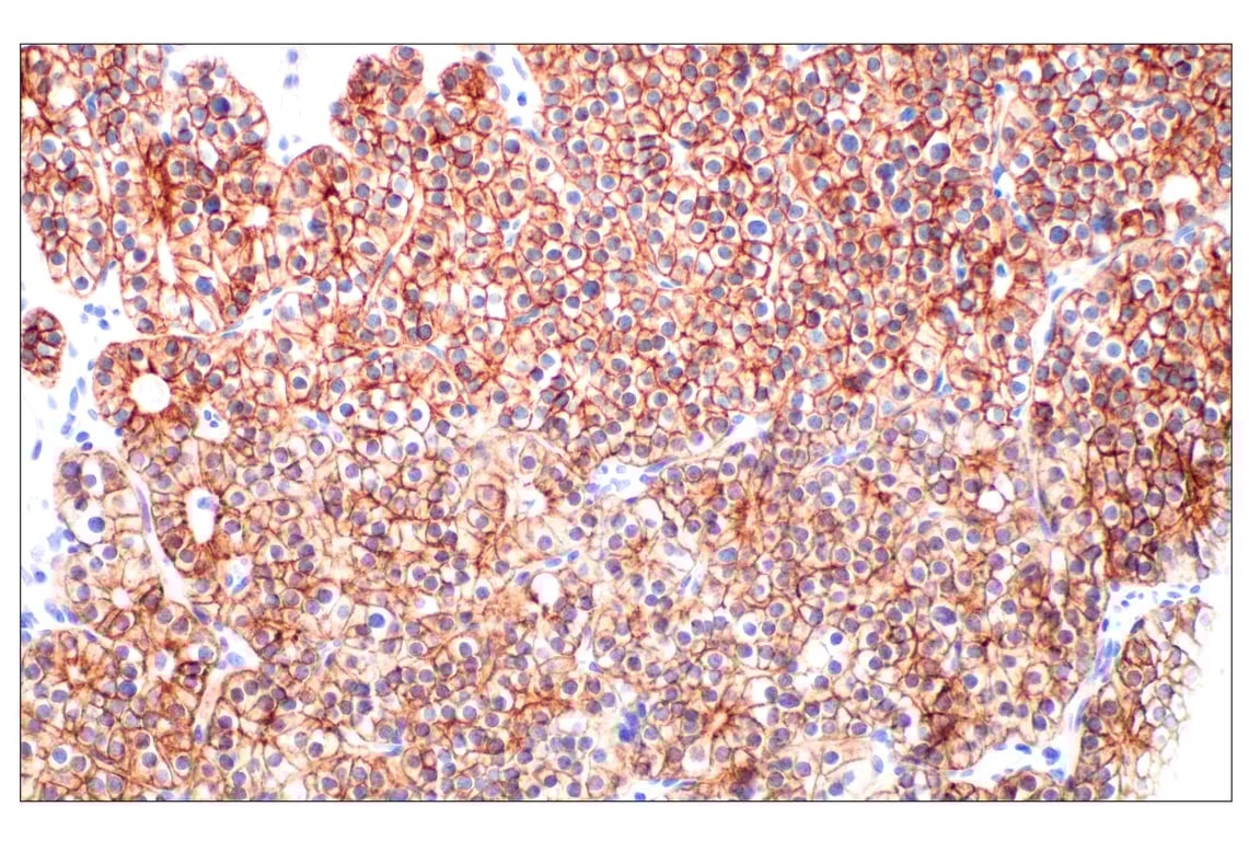 Immunohistochemistry Image 7: Pan-Keratin (Type I) (E6S1S) Rabbit Monoclonal Antibody