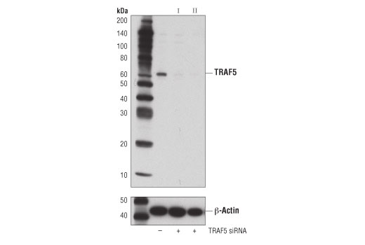 Western Blotting Image 3: TRAF5 (D3E2R) Rabbit Monoclonal Antibody