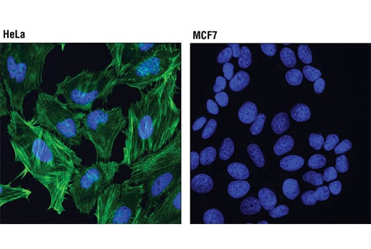 Immunofluorescence Image 1: Caldesmon-1 (D5C8D) Rabbit Monoclonal Antibody