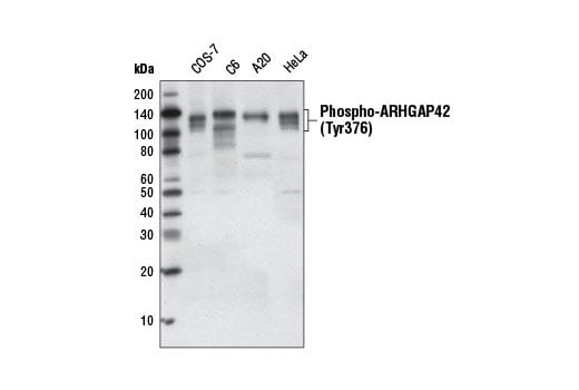 Western Blotting Image 2: Phospho-ARHGAP42 (Tyr376) (D45E9) Rabbit Monoclonal Antibody